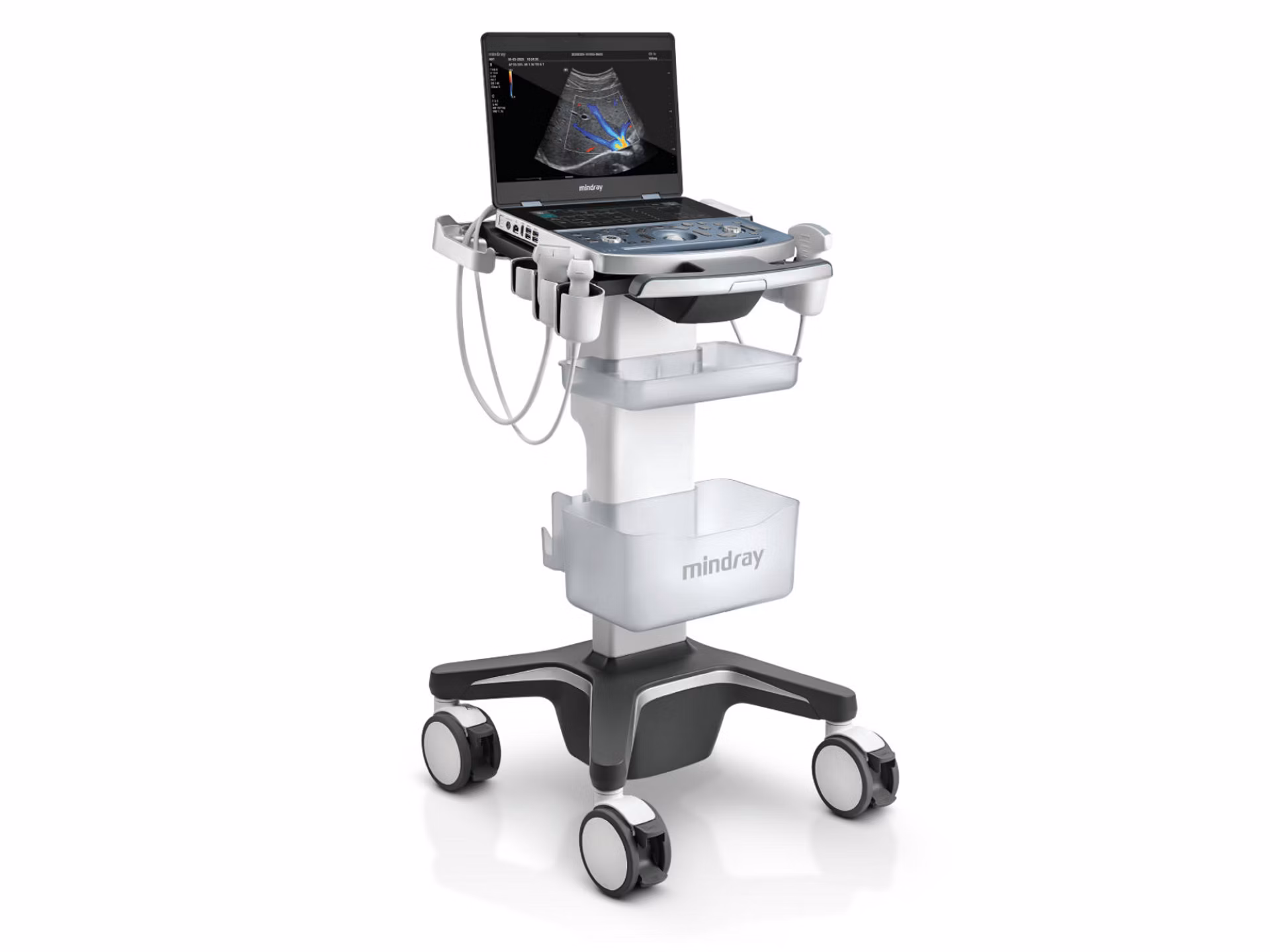 Mindray MX7 Ultrasound System used by ECHOHeart Imaging